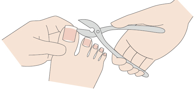正しい爪の切り方 エンゼルの介護用品 ベビー用品の通販サイト ゆうゆうショッピング